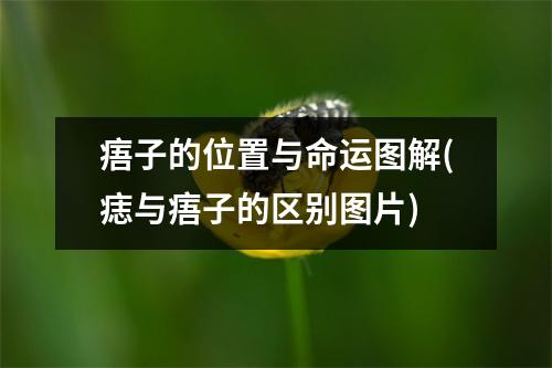 痦子的位置与命运图解(痣与痦子的区别图片)