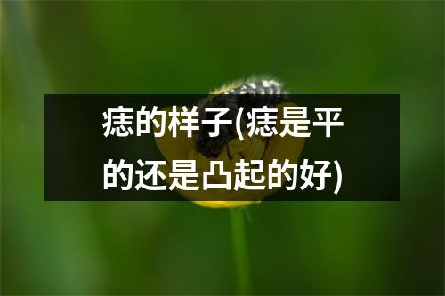 痣的样子(痣是平的还是凸起的好)