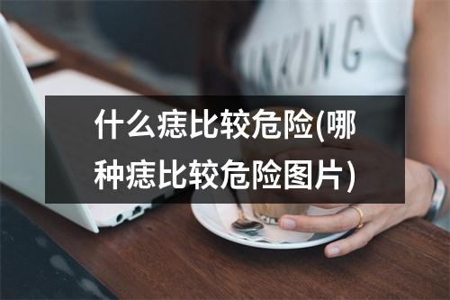 什么痣比较危险(哪种痣比较危险图片)