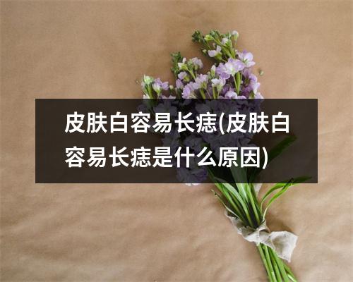 皮肤白容易长痣(皮肤白容易长痣是什么原因)