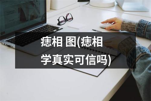 痣相 图(痣相学真实可信吗)