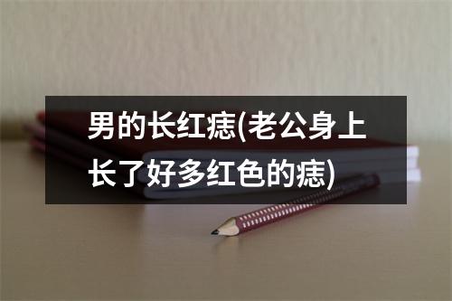 男的长红痣(老公身上长了好多红色的痣)