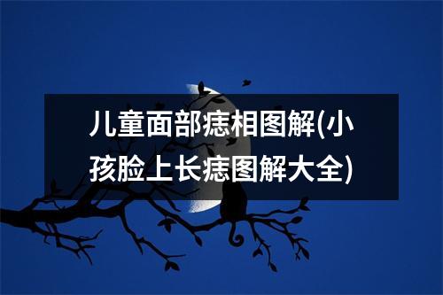 儿童面部痣相图解(小孩脸上长痣图解大全)