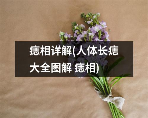 痣相详解(人体长痣大全图解 痣相)