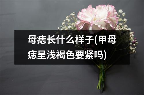 母痣长什么样子(甲母痣呈浅褐色要紧吗)