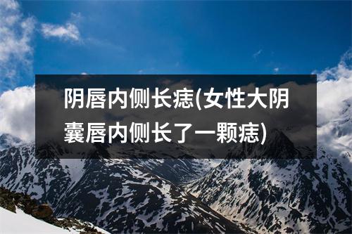 阴唇内侧长痣(女性大阴囊唇内侧长了一颗痣)