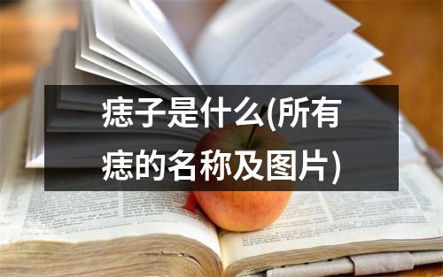 痣子是什么(所有痣的名称及图片)