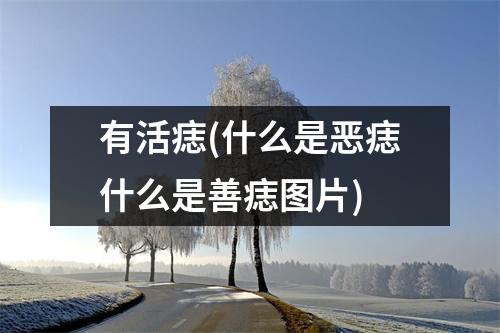 有活痣(什么是恶痣什么是善痣图片)