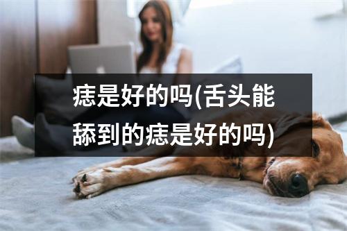 痣是好的吗(舌头能舔到的痣是好的吗)