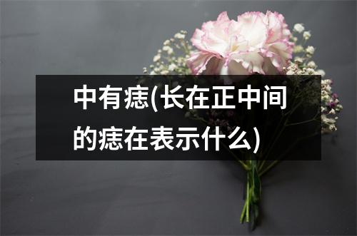 中有痣(长在正中间的痣在表示什么)