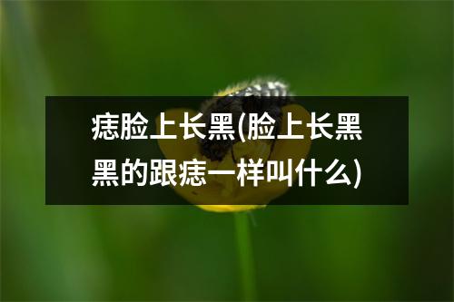 痣脸上长黑(脸上长黑黑的跟痣一样叫什么)